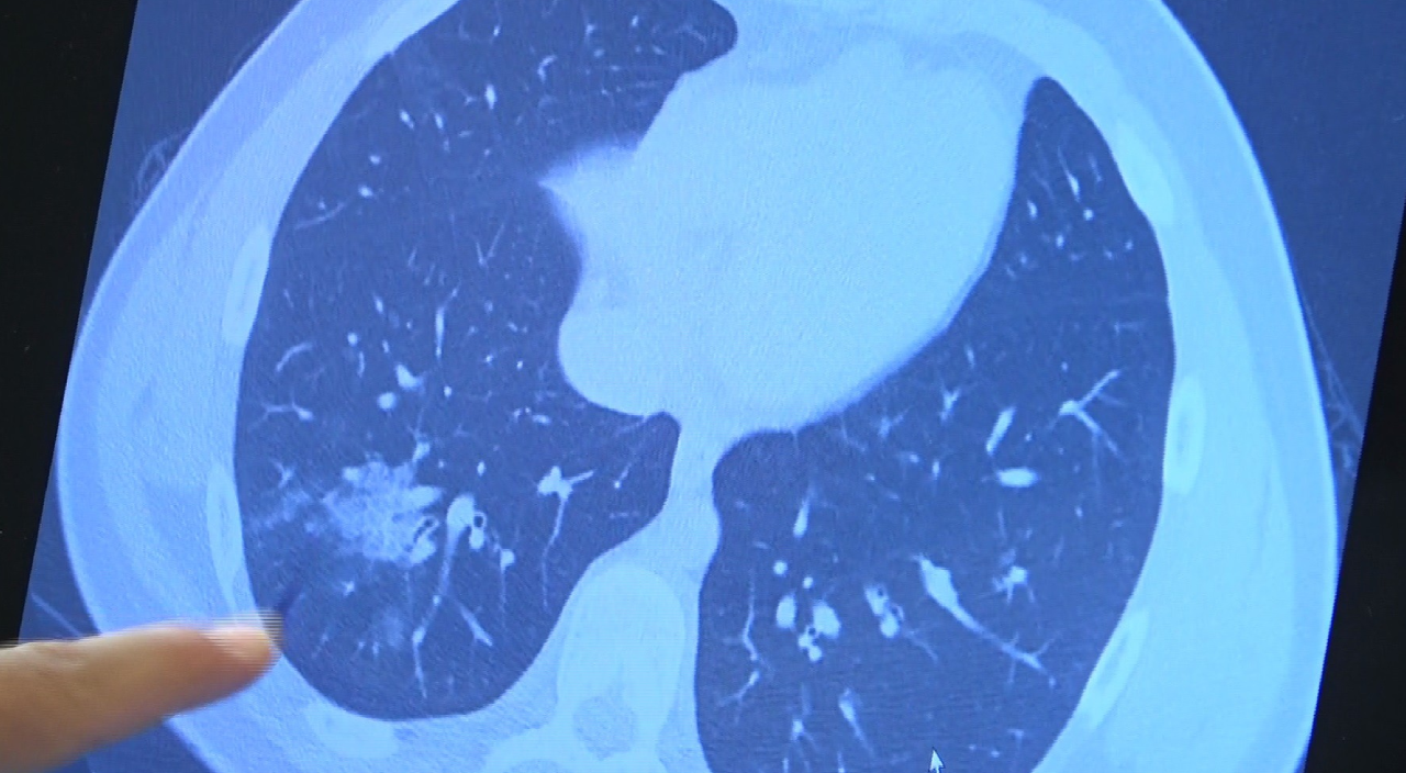 Prof. Dr. Özkaya: 'Çocuklarımız mutlaka aşı olmalı'